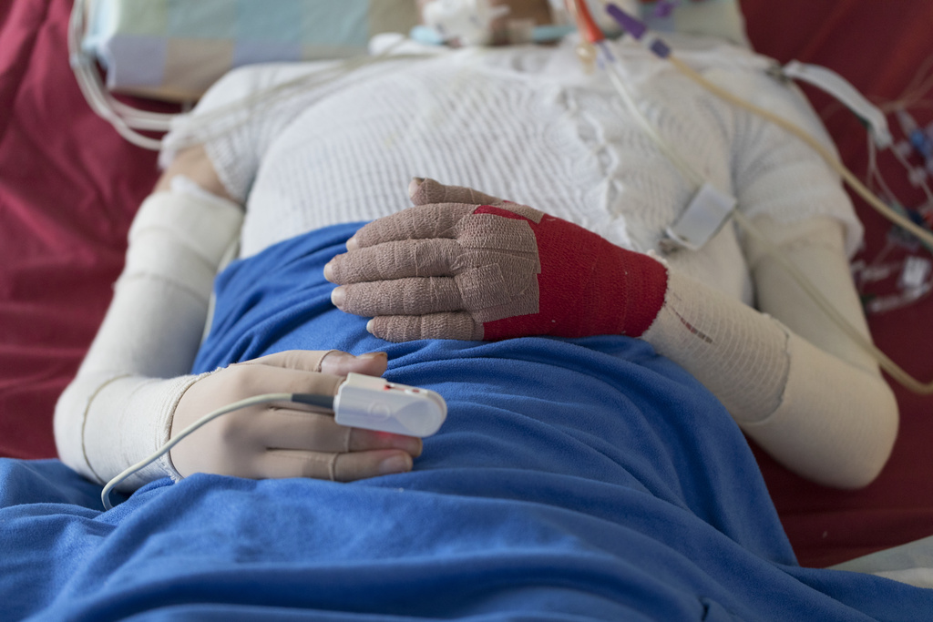 28 të lënduar nga zjarri në Crans Montana vazhdojnë të jenë të shtruar në spitalet zvicerane