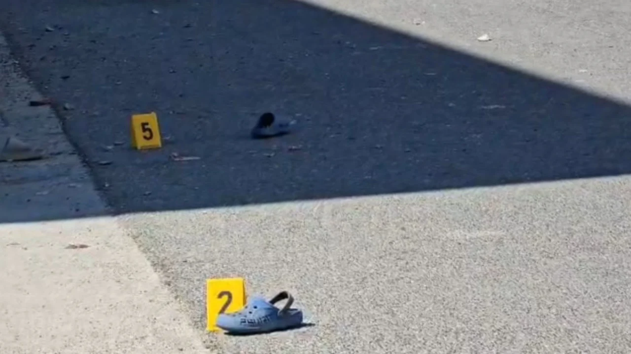 Durrës  Fëmija i tretë i aksidentuar jashtë rrezikut për jetë
